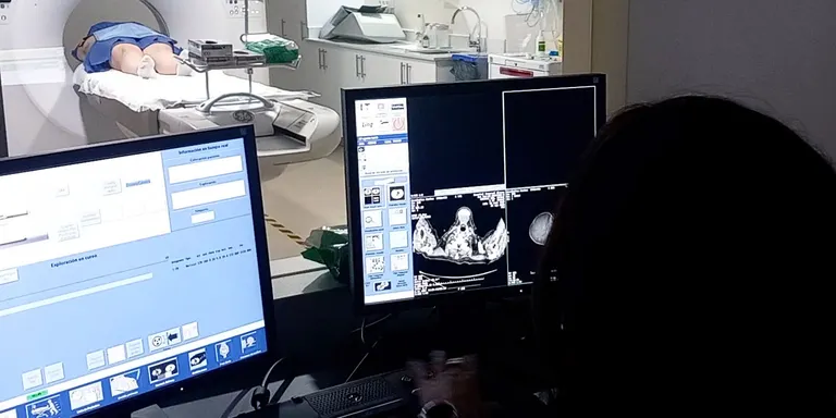 L'Hospital de Blanes incorpora un nou TAC amb tecnologia d'última generació