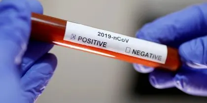 ESPECIAL CORONAVIRUS: Dilluns 23 de març (migdia)