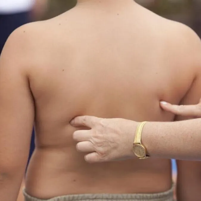 Somni Psicologia “Gordofobia infantil”
