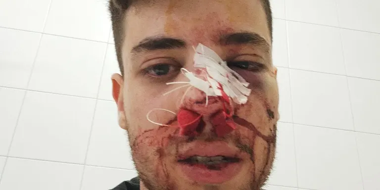 Gerard Parés, president del Club Vilassar Hoquei: “Ens hem quedat de pedra amb la sanció al jugador que va agredir Pau Vilaró”