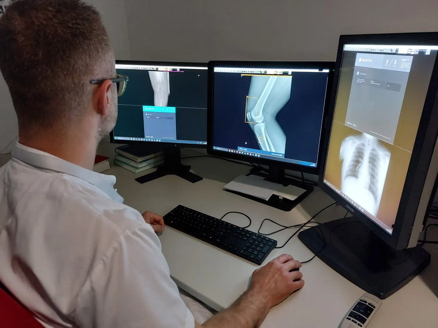 El Pius Hospital incorpora la intel·ligència artificial per a exploracions radiològiques de tòrax i òssies