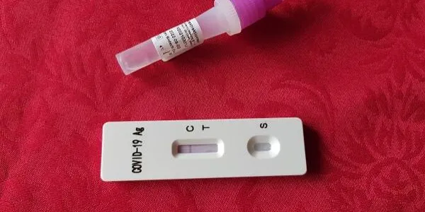 La rebaixa en el preu dels tests d'antígens, a màxim 2,94€, un alleugeriment per l'usuari i un maldecap per a les farmàcies