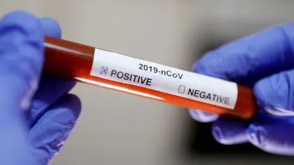 ESPECIAL CORONAVIRUS: Dilluns 23 de març (migdia)