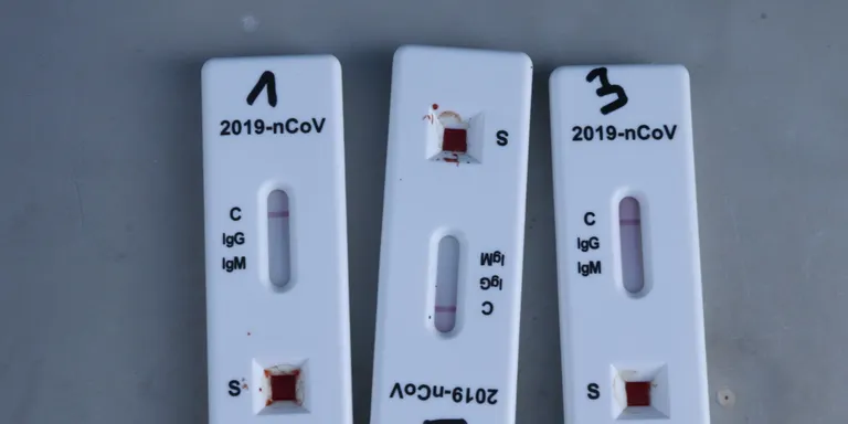 Aprovada la venda de test d'antígens a les farmàcies sense recepta