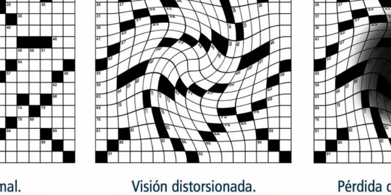 L'Institut de la Màcula i Farmaoptics, junts contra la DMAE