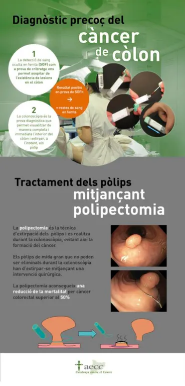 Xerrada sobre el càncer colorectal a Can Comas