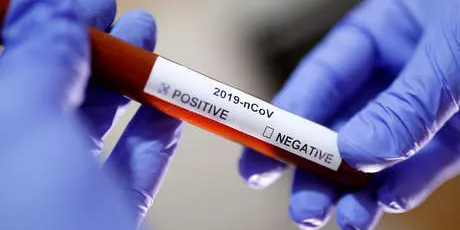 La OMS alerta als ciutadans amb viatges contractats a zones afectades pel Coronavirus