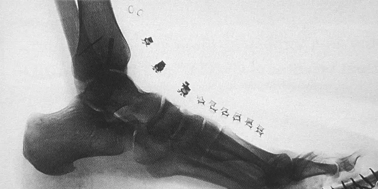 El Gra explorarà la relació entre fotografia i radiologia en la figura del Dr. César Comas