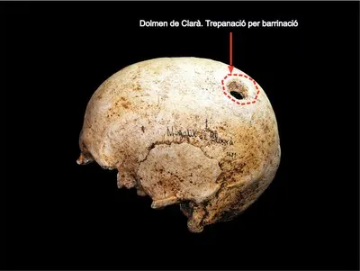 Dues peces del Museu de Solsona s’exposen a la mostra itinerant “Viure la mort” de la Xarxa de Museus de les Terres de Lleida i Aran