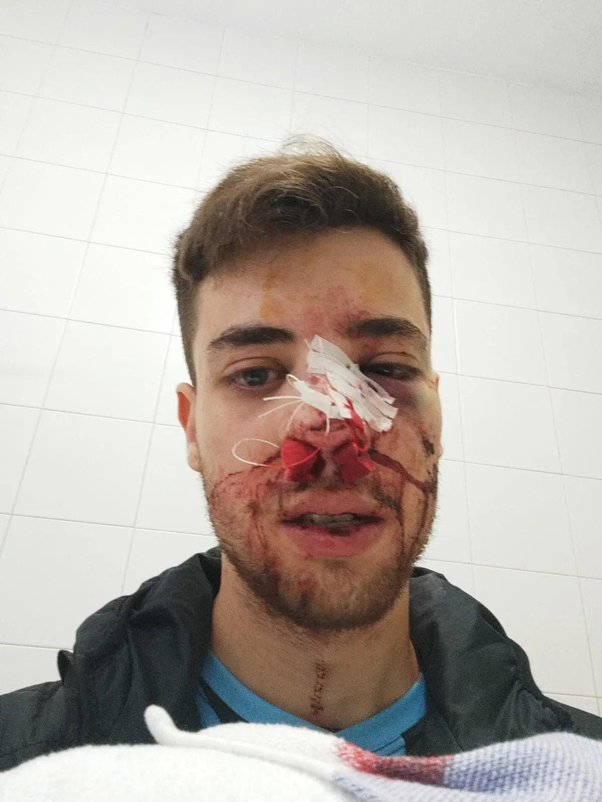 Gerard Parés, president del Club Vilassar Hoquei: “Ens hem quedat de pedra amb la sanció al jugador que va agredir Pau Vilaró”
