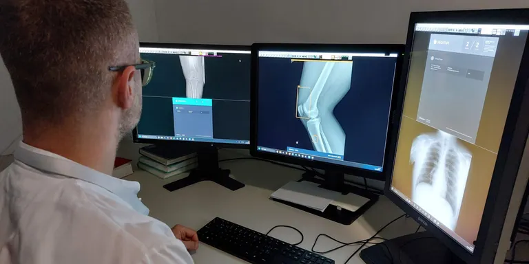 El Pius Hospital incorpora la intel·ligència artificial per a exploracions radiològiques de tòrax i òssies