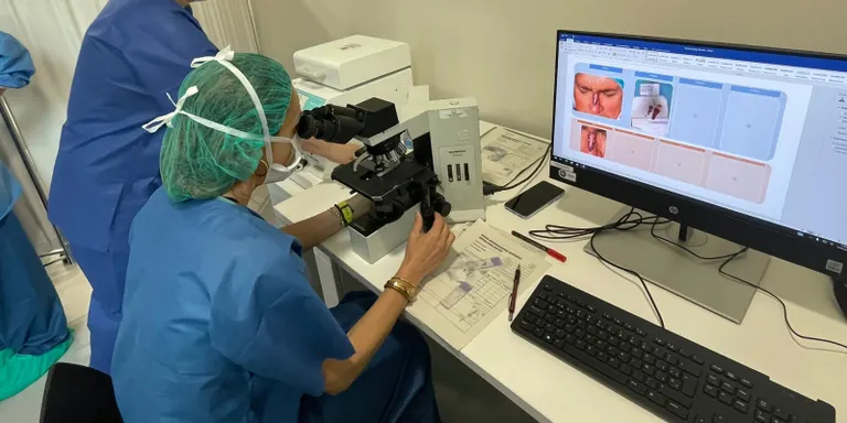 L’Hospital General de Granollers millora el tractament de tumors cutanis amb la cirurgia microgràfica de Mohs