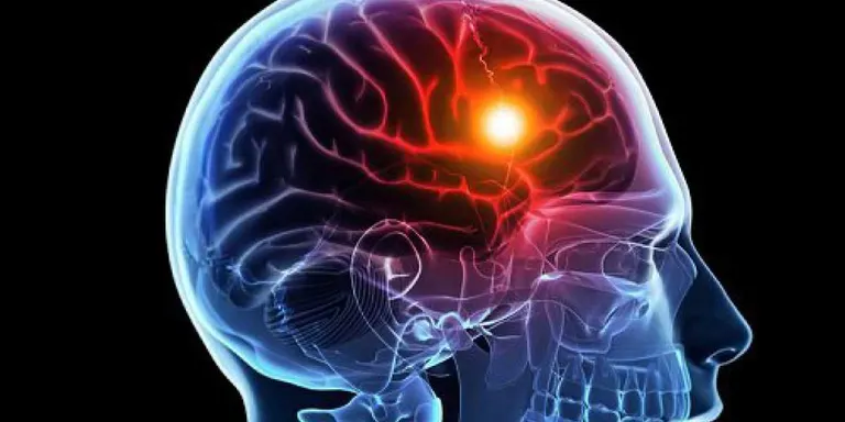 Xerrada divulgativa sobre l'Ictus i les lesions medul·lars i cerebrals traumàtiques