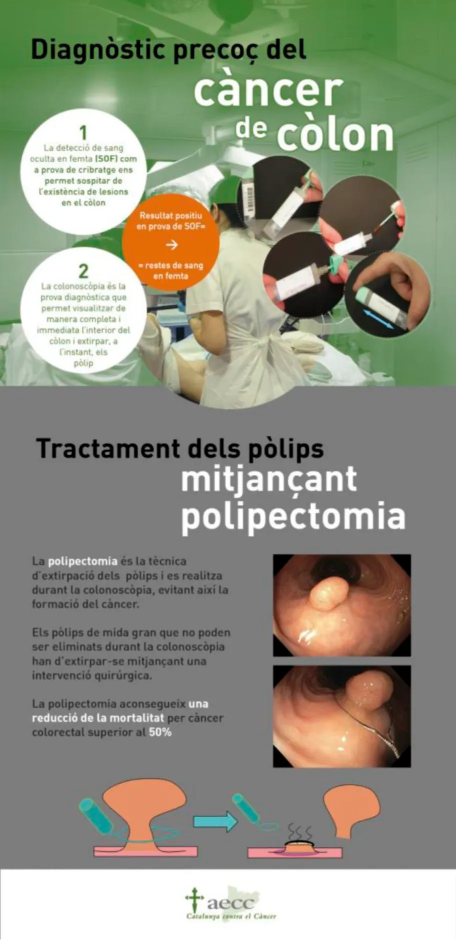 Xerrada sobre el càncer colorectal a Can Comas