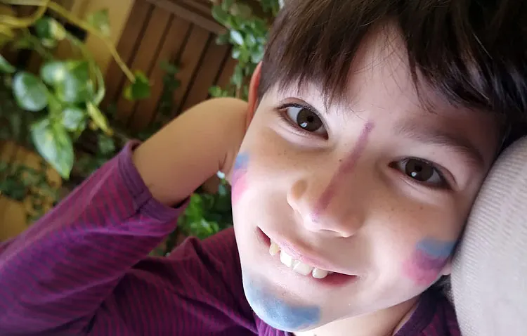 La historia de Nico, el niño utrerano de 10 años que padece una enfermedad rara